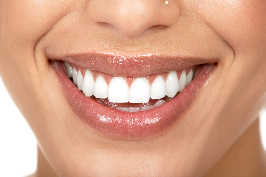 Affordable Porcelain Veneers in Mexico Dental Destinations Cancun