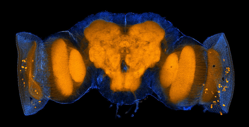 Brain Actin alone.jpg