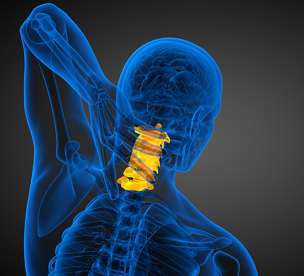 Alt=''Cervical Spine/Neckpain/ ACDF/Corpectomy/Dr Basil Al Sharef''