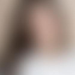 Warum deine Haut gleichzeitig trocken und fettig ist, und was wirklich hilft.