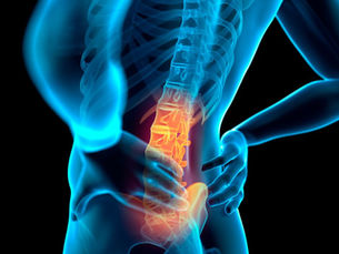 Lower back pain