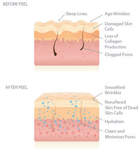 before & after Peel-03-01.jpg
