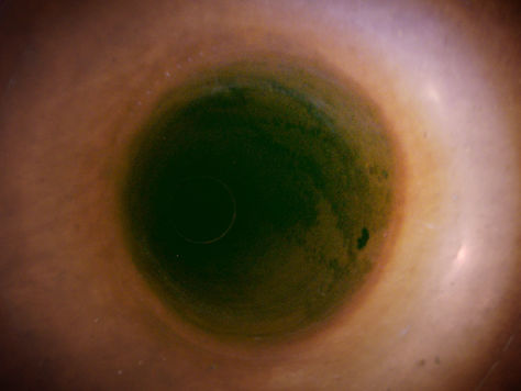 Princip kruga: Aleksandar Tanurdžić