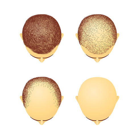 kit alopecia, celulas madre, factor de c