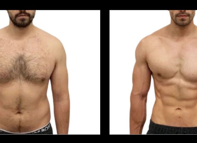 The Michaud Method - Before & After Photos.jpg