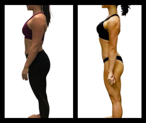 Michaud Method Transformation Photo