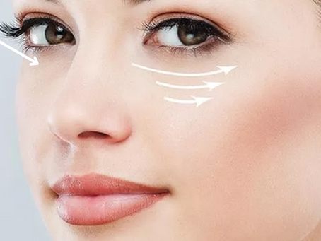 Tear Trough Procedure: What You Need to Know