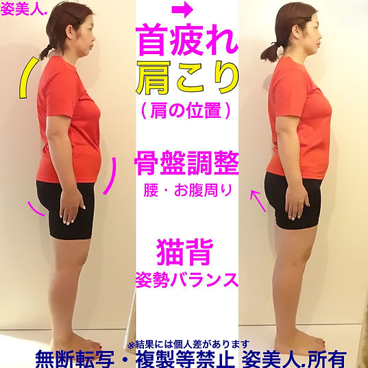 猫背で姿勢が悪く肩こり疲労に悩む女性がシルエットで整体と小顔矯正の施術を受けた時のビフォーアフター写真 むくみやフェイスラインがスッキリした 大阪 筋膜リリース リフトアップ 良い写真