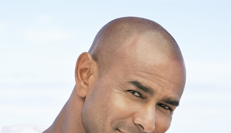 2 Days Scalp Hair Micropigmentation Training 2 500