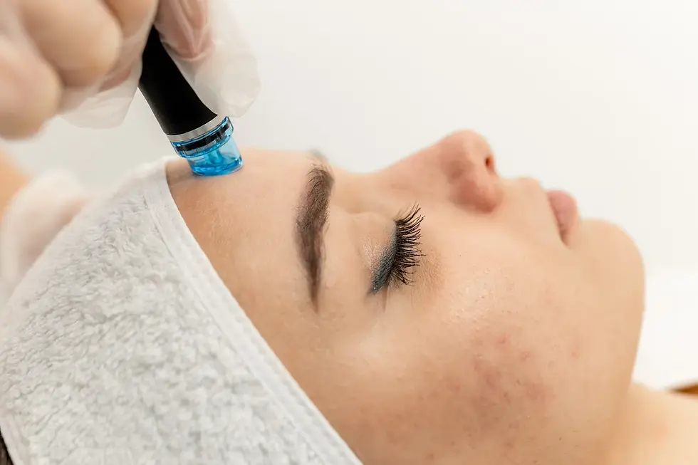What HydraFacial Do - And Why Everyone’s Talking About It