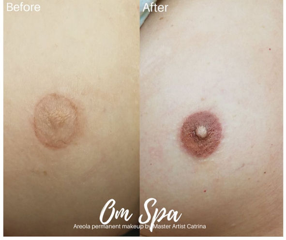 Areola