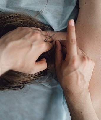 Western Acupuncture Movement Mechanics Osteopathy Auckland