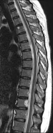 Click neck pain relief