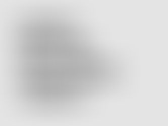 Shockwave Therapy for the treatment of elbow pain at Movement Mechanics Osteopathy Auckland