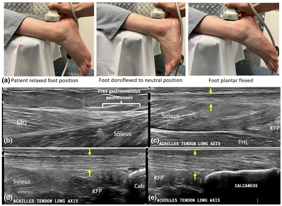 Achilles tendinopathy ultrasound