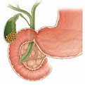 cholecystectomy.jpeg