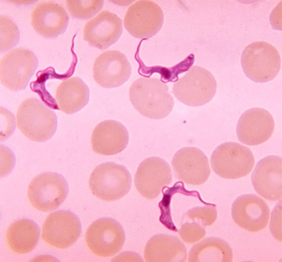 Board Prep: Overview of Donor Infectious Disease Eligibility