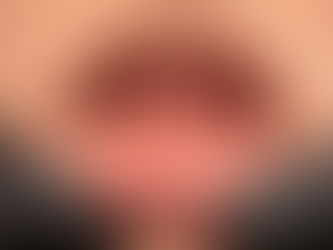 El cáncer de boca se puede prevenir si estamos atentos a las señales