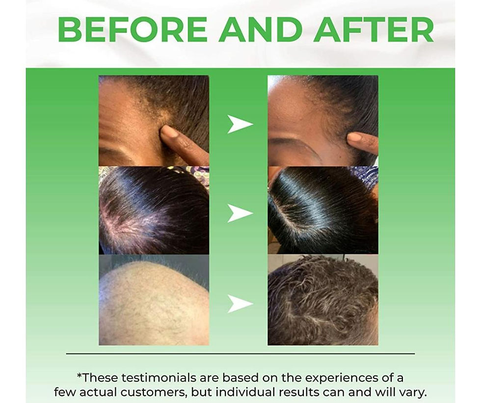 Thumbnail: Biotin Hair Growth Serum Advanced Topical Formula To Help Grow Healthy, Strong H