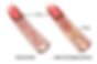 Difference Between Atherosclerosis and Arteriosclerosis