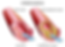 Difference Between Atherosclerosis and Arteriosclerosis