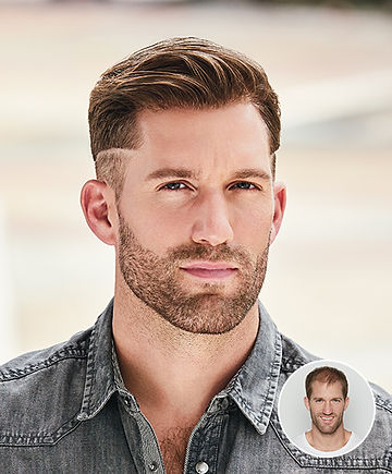 Mens Hair Replacement system