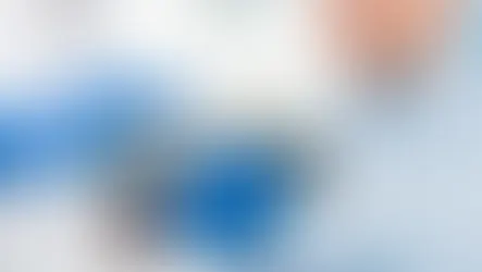 5 דברים שחשוב לדעת לפני ציפוי שיניים