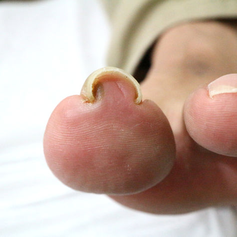 Why Some Nails Never Turn Out Right (And It’s Not Your Technique)