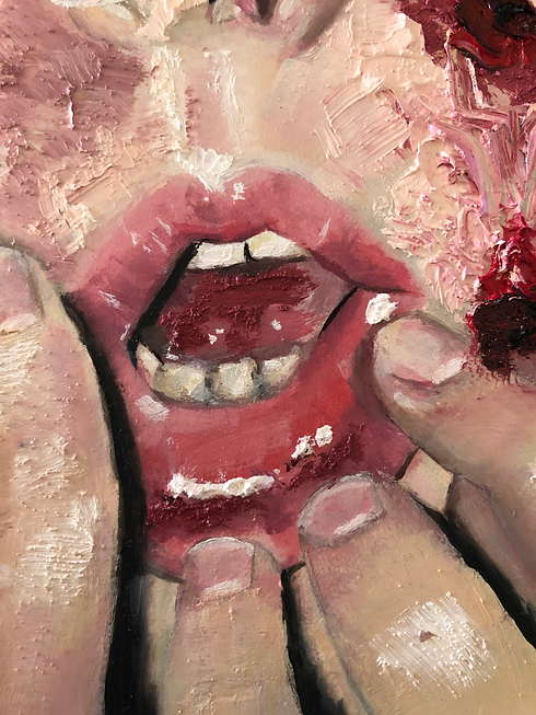 dermatillomania.HEIC