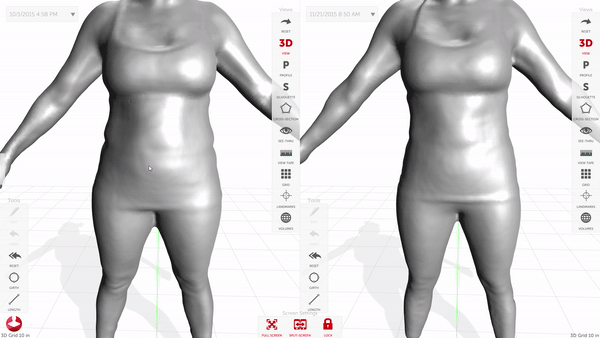 bodyscan.gif