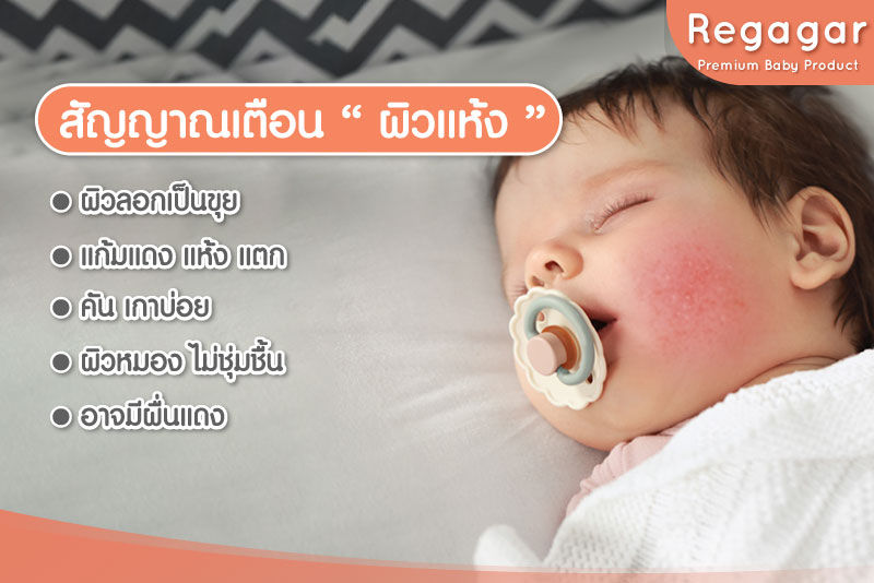 ผิวแห้ง
