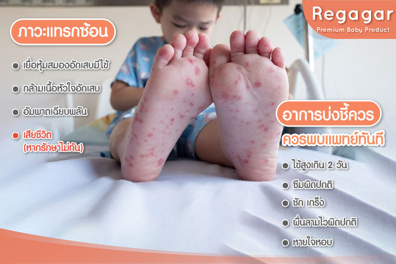 ภาวะแทรกซ้อน มือเท้าปาก