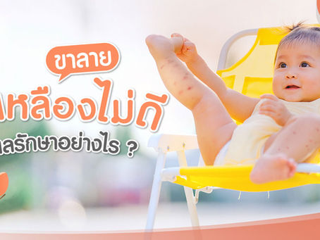 น้ำเหลืองไม่ดี ขาลาย ดูแลรักษาอย่างไร ?