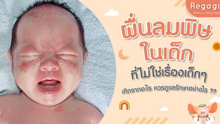 ผื่นลมพิษ ในเด็ก ที่ไม่ใช่เรื่องเด็กๆ เกิดจากอะไร ควรดูแลรักษาอย่างไร ??
