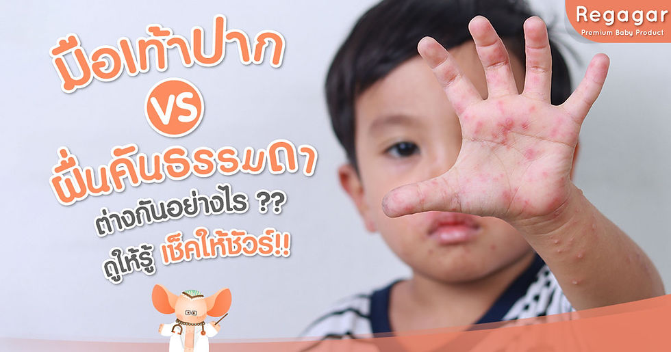 มือเท้าปาก VS ผื่นคันธรรมดา