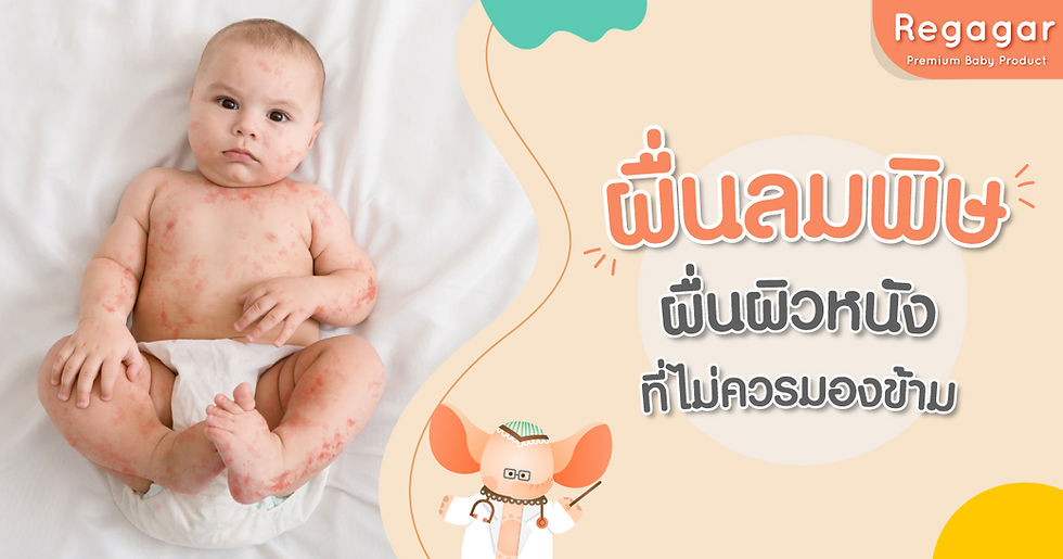 ผื่นลมพิษ
