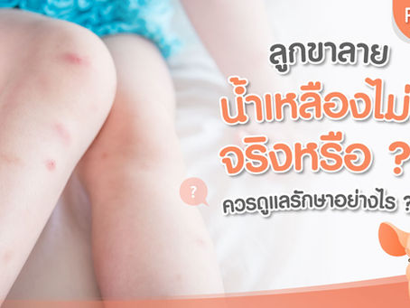 ลูกขาลาย น้ำเหลืองไม่ดีจริงหรือ ?? ควรดูแลรักษาอย่างไร?