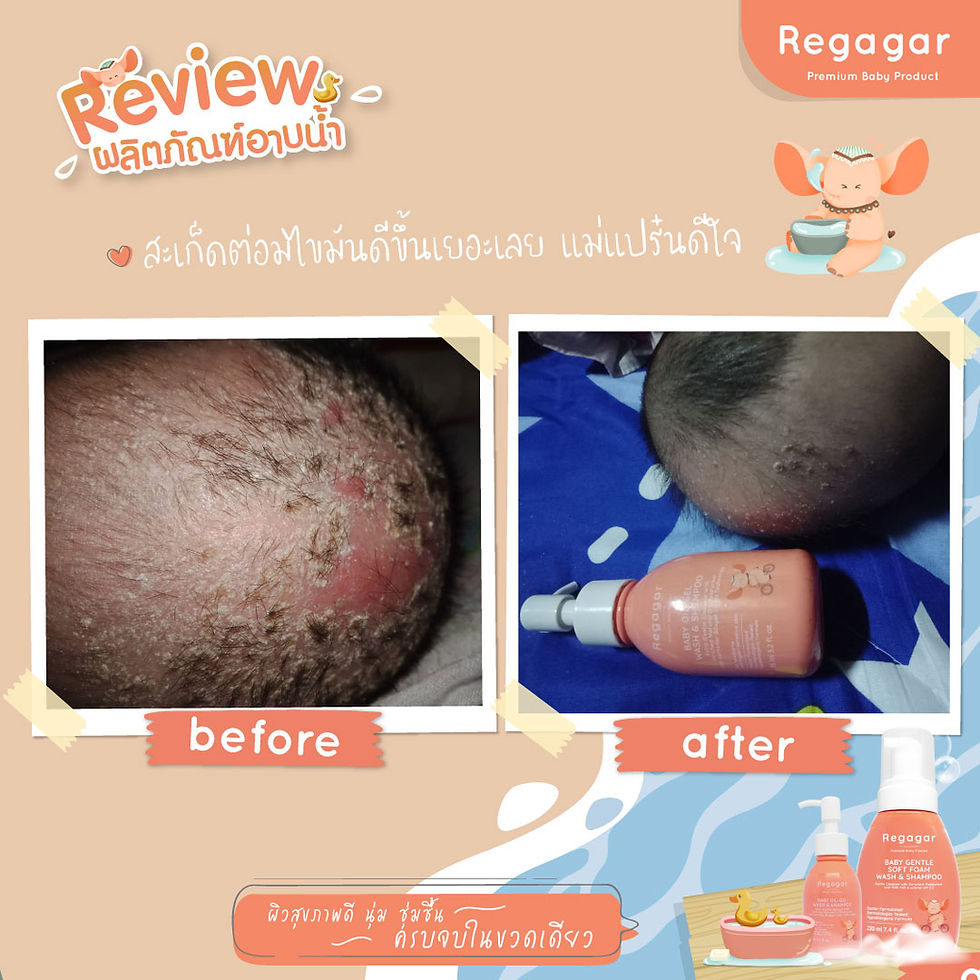 ภาพขนาดย่อ: OIL-MILK STEP1 WASH AND SHAMPOO