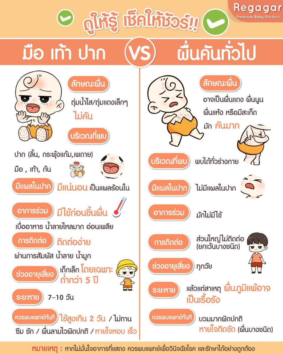 มือเท้าปาก VS ผื่นคันทั่วไป