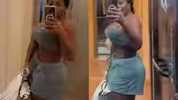 Jojo Todynho rebate boatos sobre lipedema e pede responsabilidade em diagnósticos