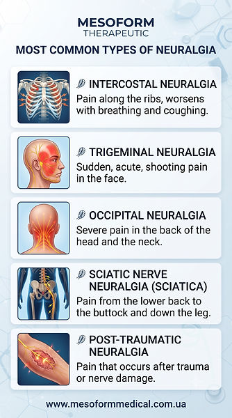 Main types of neuralgia and common pain locations