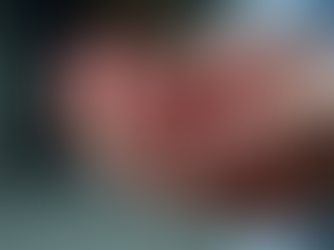 Identifying Psoriatic Arthritis Symptoms