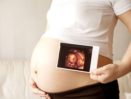 O que é ultrassom 3D ou 4D?