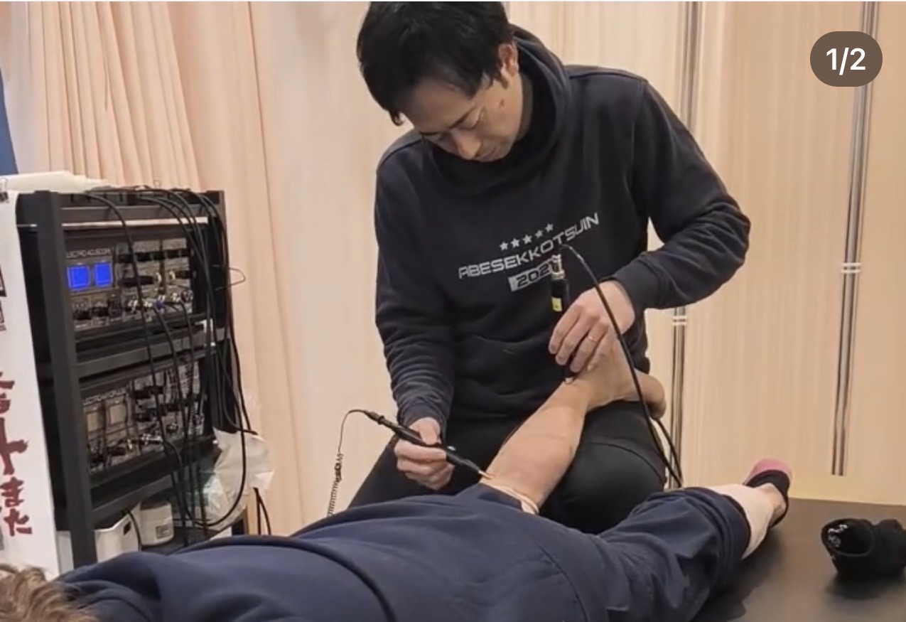 アキュスコープを使った施術
