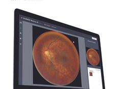 XAIMED Officially Introduces 'Fundus-CVD AI' Solution to 17 Branches of MEDICHECK