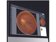 XAIMED Officially Introduces 'Fundus-CVD AI' Solution to 17 Branches of MEDICHECK