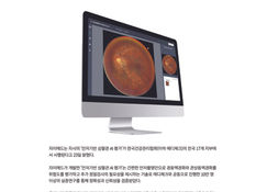 XAIMED Officially Introduces 'Fundus-CVD AI' Solution to 17 Branches of MEDICHECK
