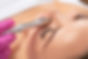 Beautiful girl with clean fresh skin.Cosmetologist makes procedure microdermabrasion on t