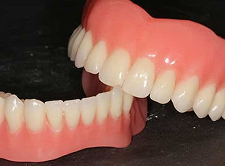 protesis-dentales-totales (1).jpg