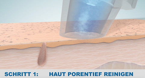 Grafik-1-für-Schritt-1-CLEAN.png